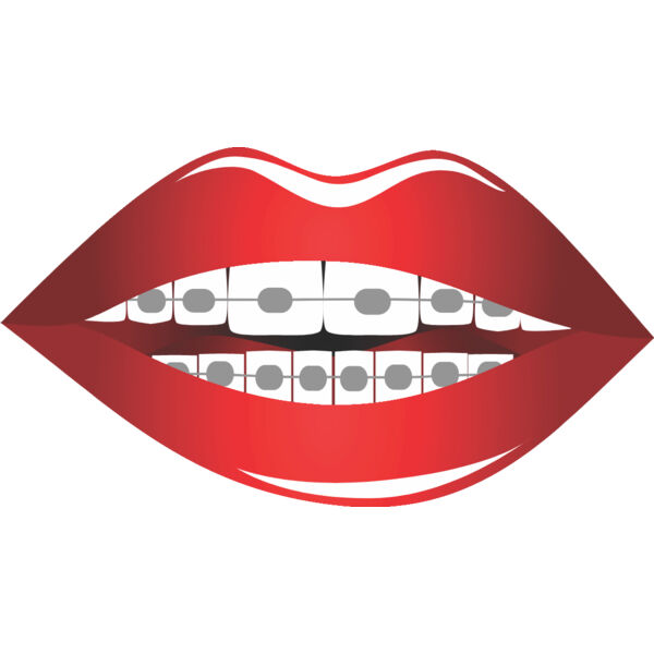 Lips Braces 2 Thumbnail